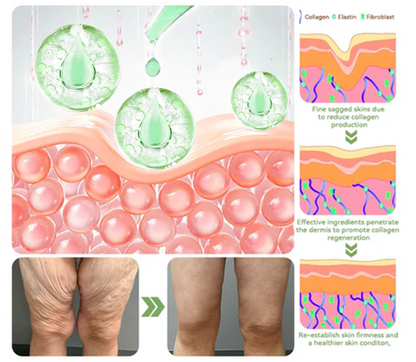 Only 6 boxes left! Enjoy a 30% discount on your second purchase! Tested by weight loss lymphologists, 4-6 boxes will leave you worry free. If you miss this opportunity, you will have to wait another year.